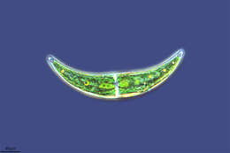 Image of Closterium moniliferum