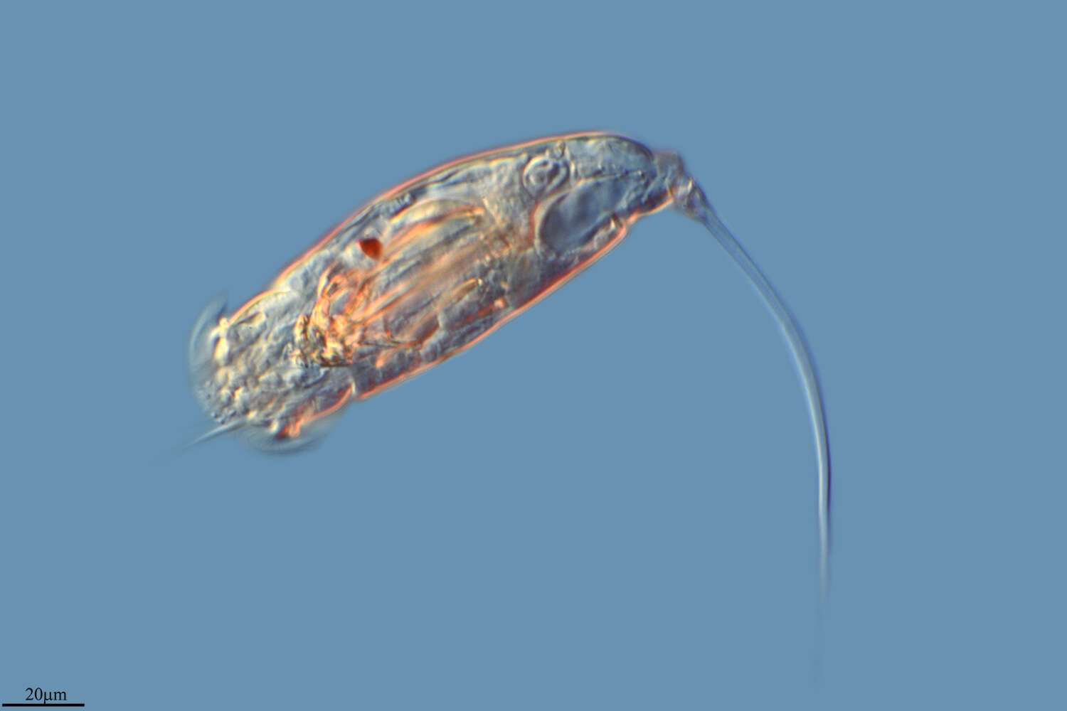 Image of Trichocercidae
