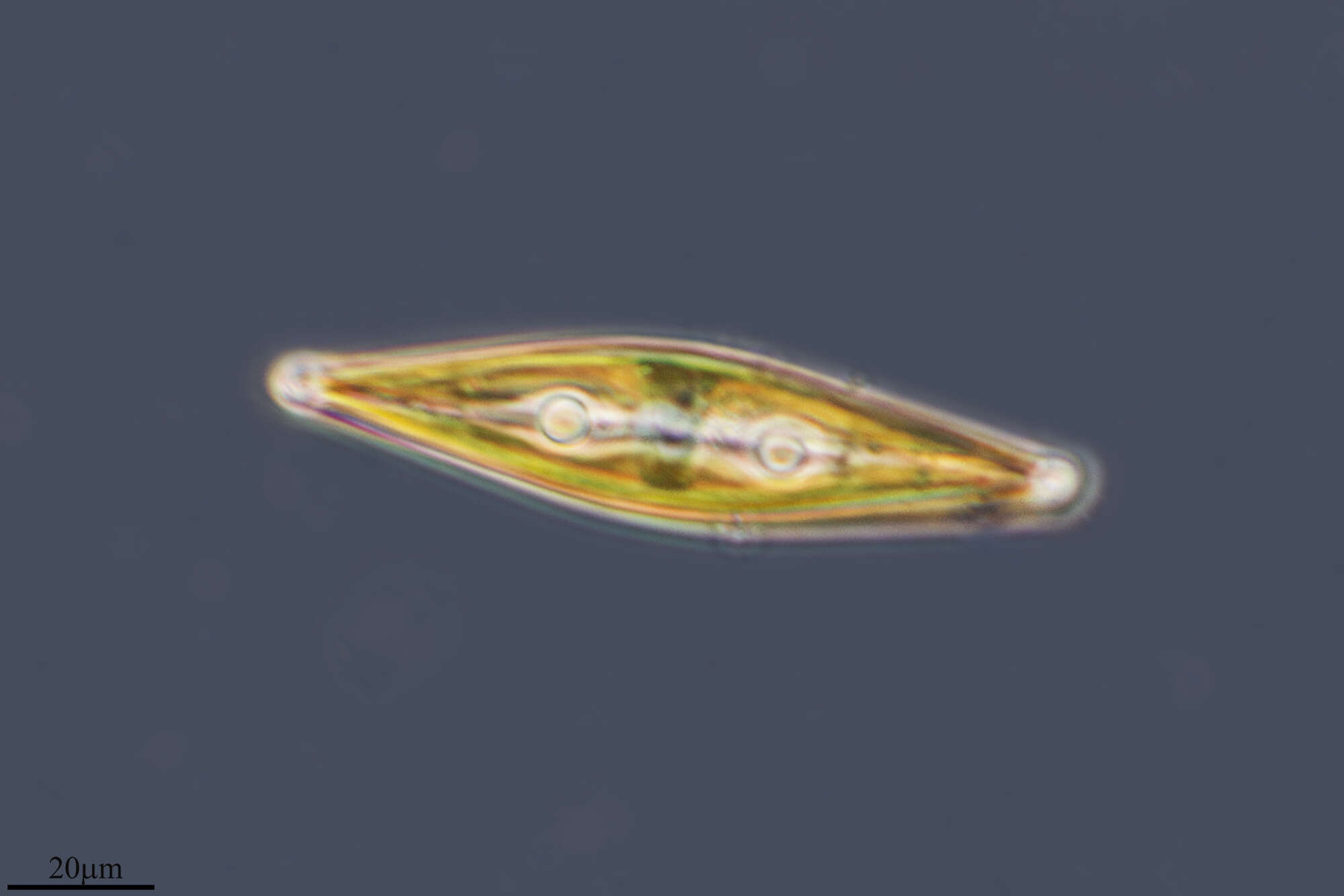 Image of SAR (Stramenopiles, Alveolates, Rhizaria)