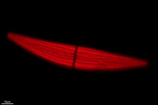 Image of Closterium lunula