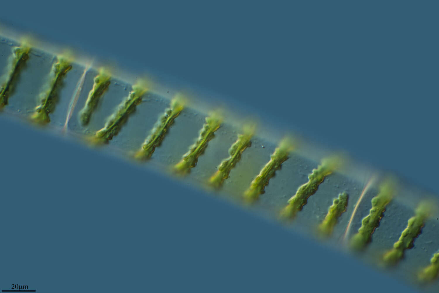 Image of Spirogyra XX