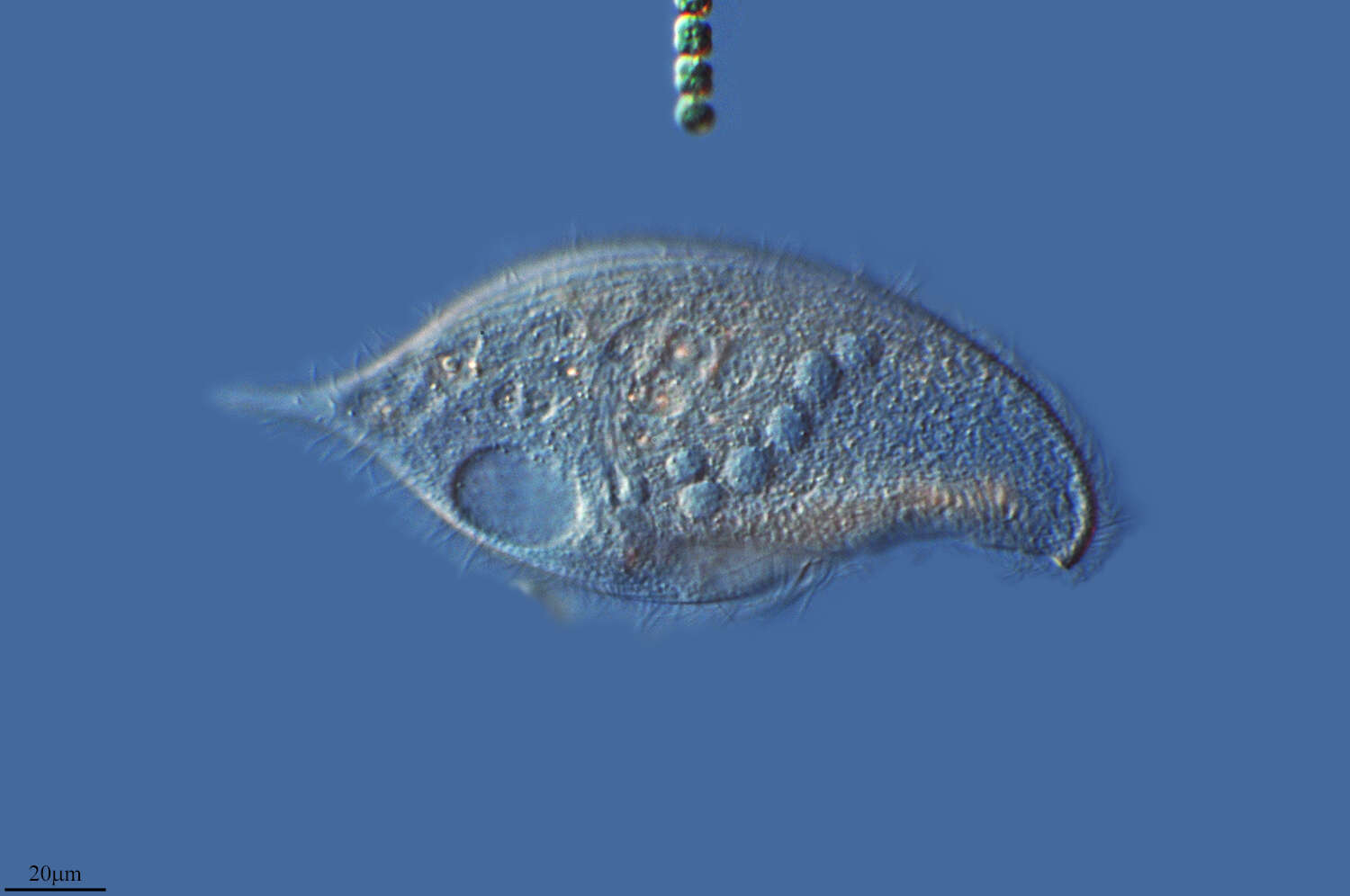 Image of Blepharismidae