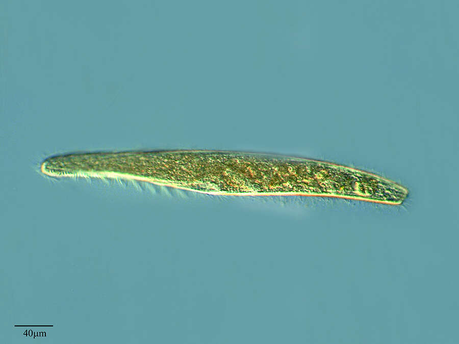 Spirostomidae的圖片