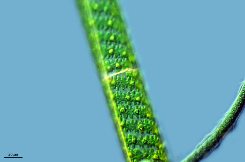 Image of Spirogyra