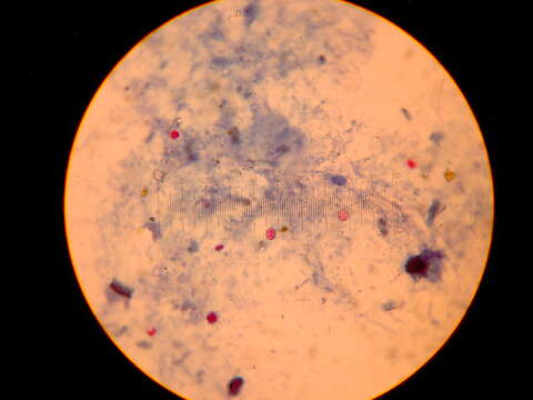 Image of apicomplexan parasites