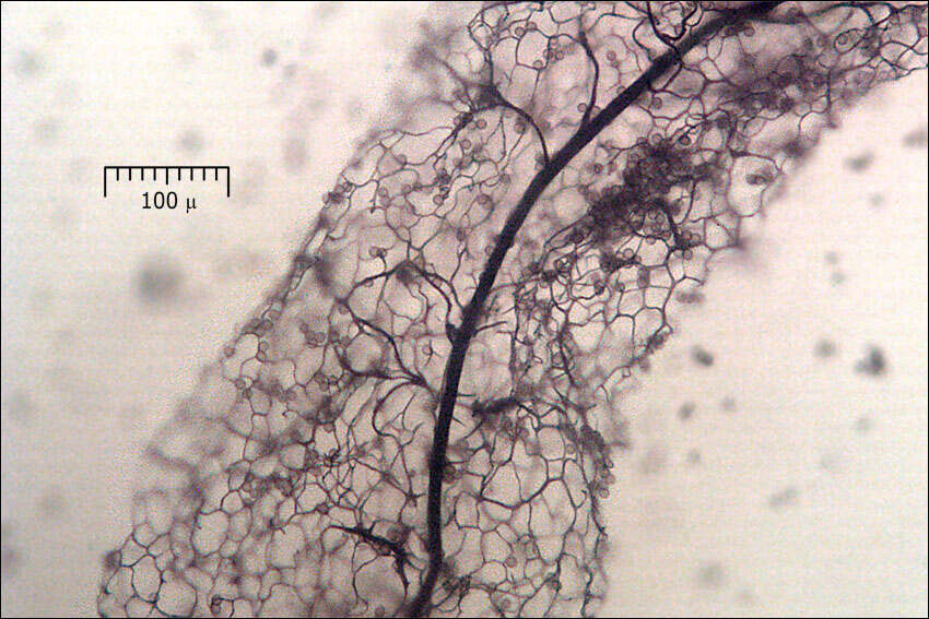 Image of Stemonitis Gleditsch 1753