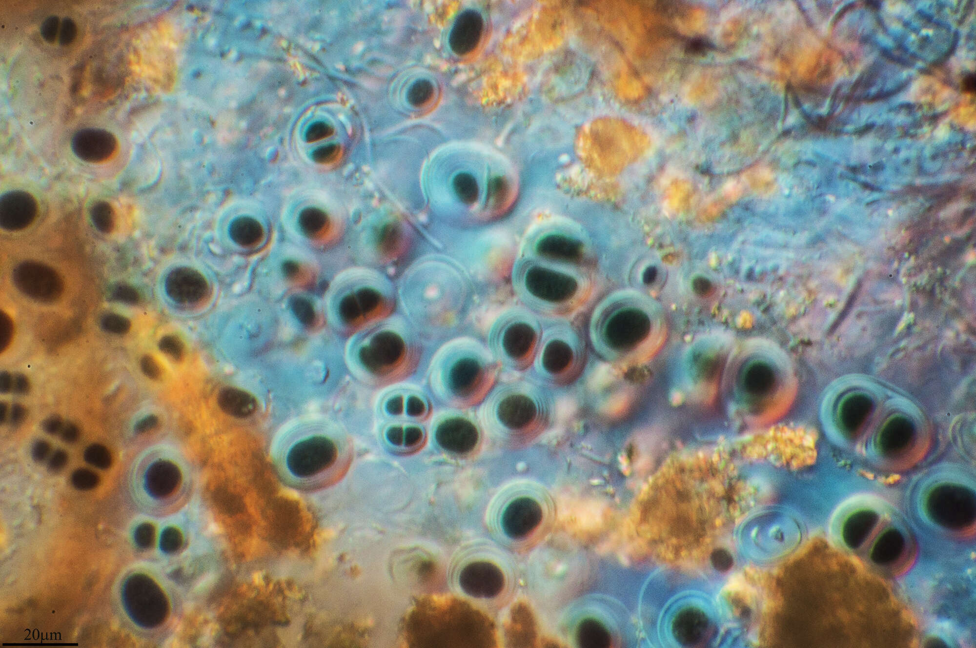 Image of Chroococcus ercegovicii Komárek & Anagnostidis 1994