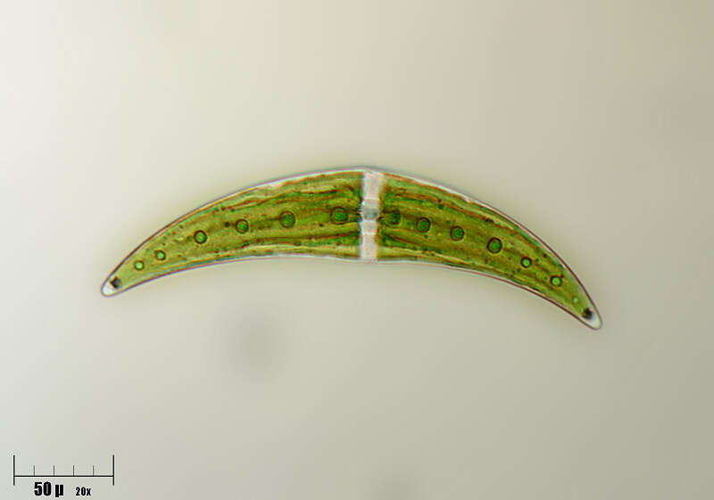 Image of Closterium moniliferum