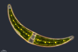 Image of Closterium moniliferum