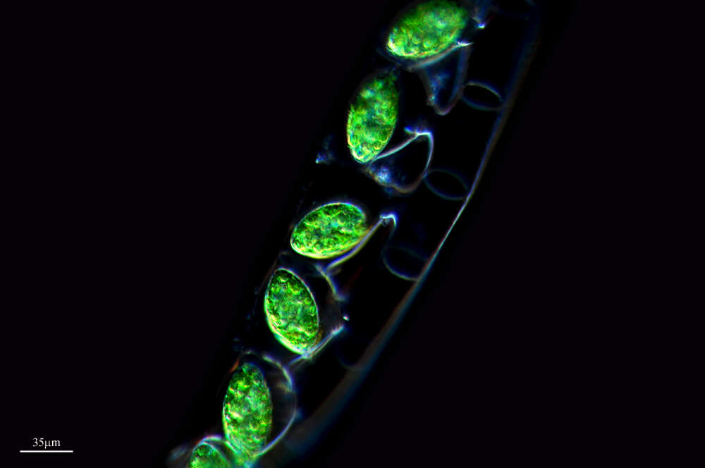 Image of Spirogyra