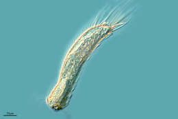 Image of gastrotrichs