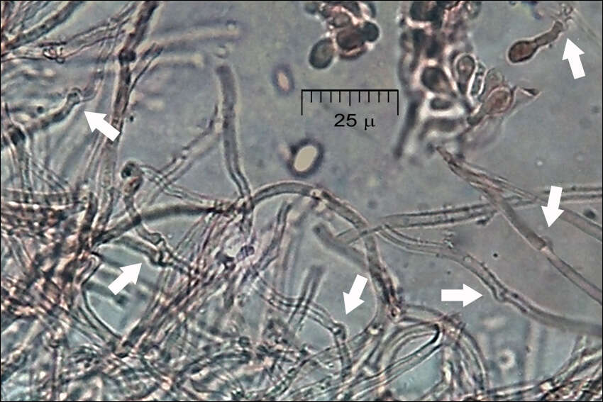 Imagem de Multiclavula mucida (Pers.) R. H. Petersen 1967