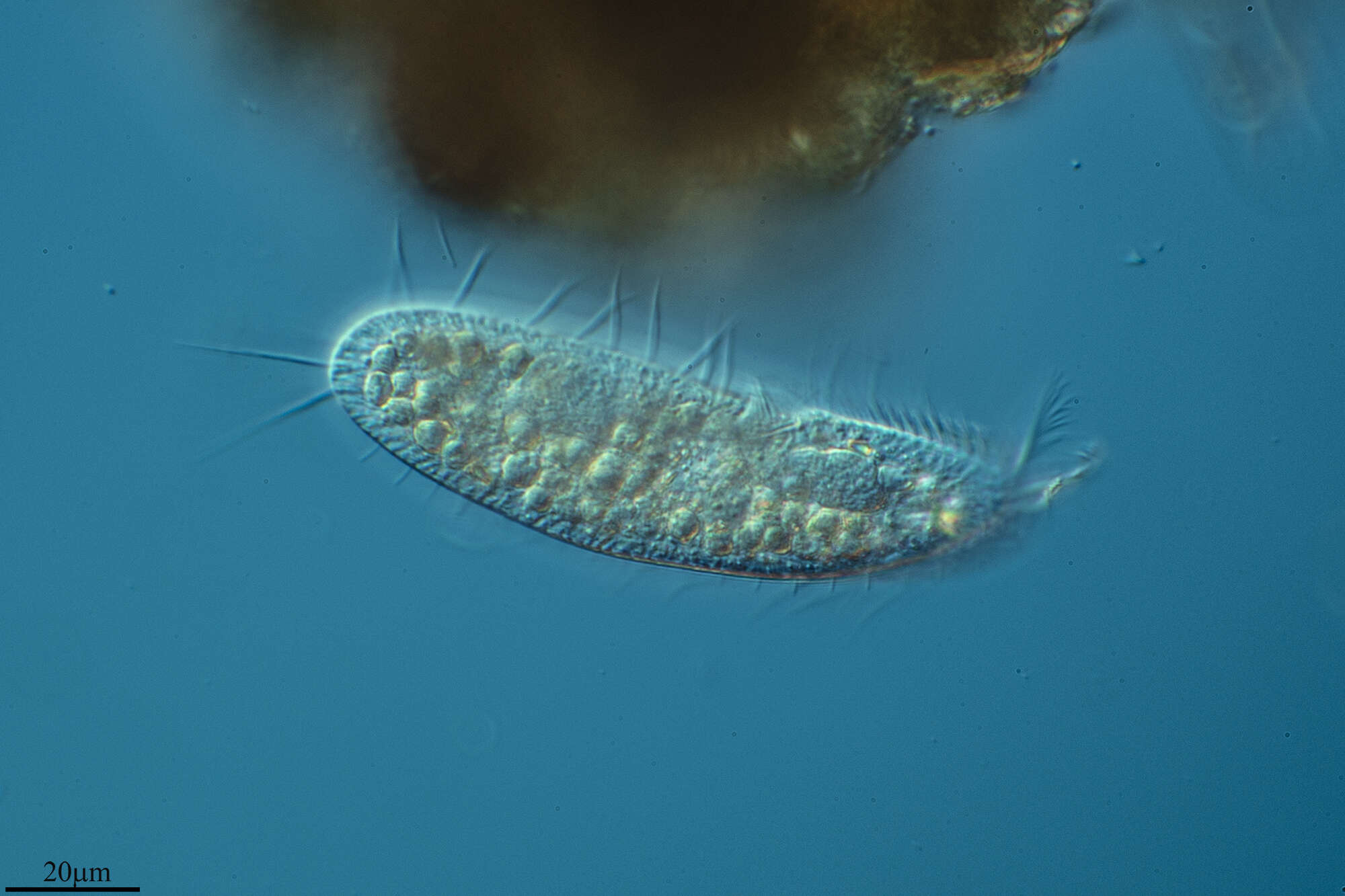 Image of Oxytrichidae