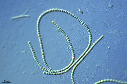 Image of Anabaena torulosa