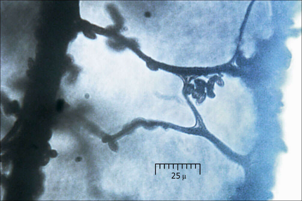 Image of Stemonitis Gleditsch 1753