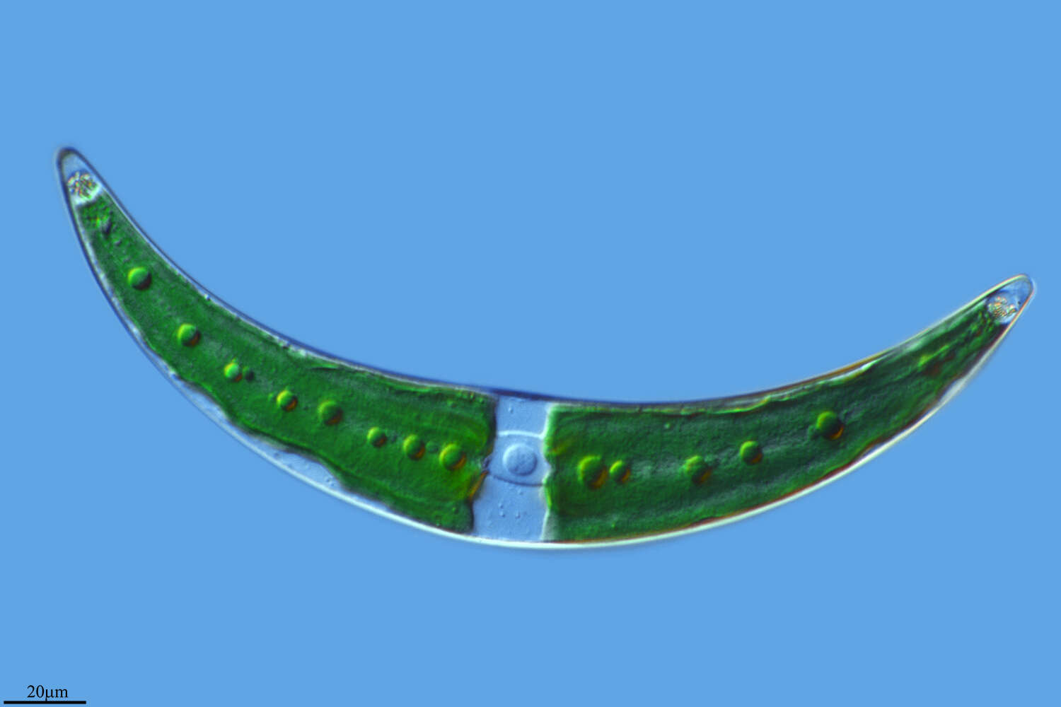 Image of Closterium moniliferum