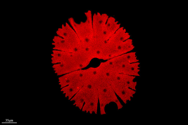 Image of Micrasterias denticulata