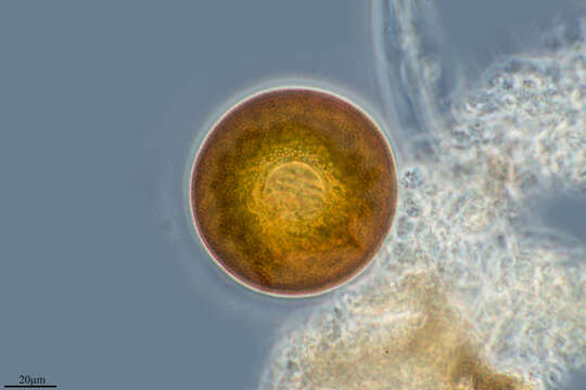 صورة Arcella vulgaris