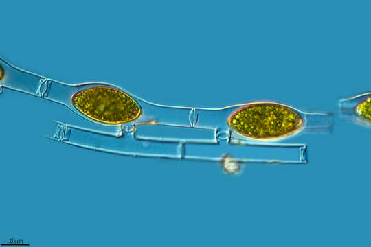 Image of Spirogyra weberi