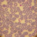 Image of Trypanosoma cruzi