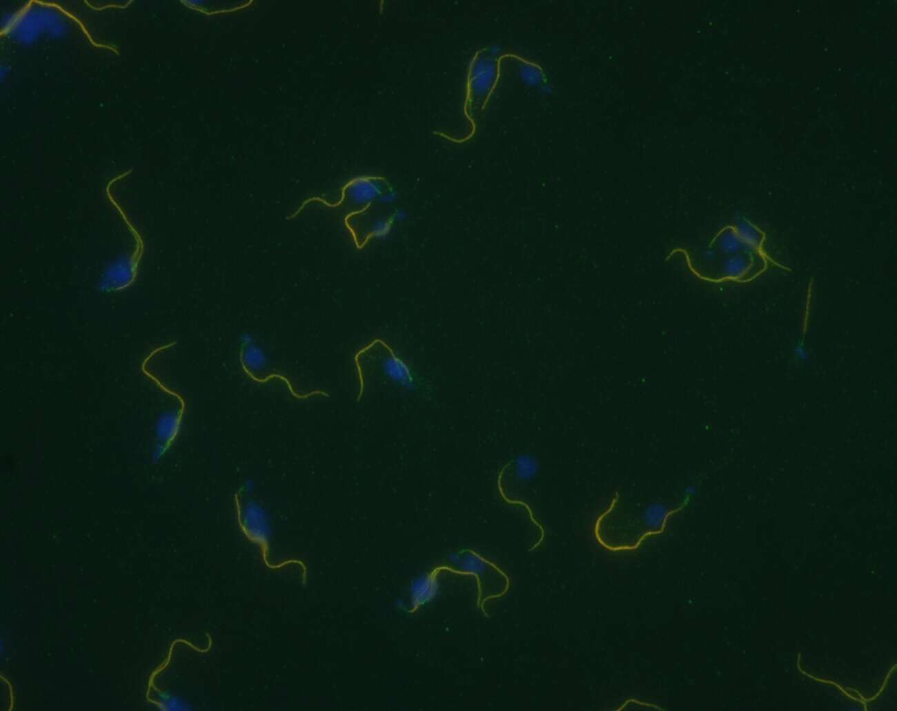 Image de Trypanosoma subgen. Trypanozoon