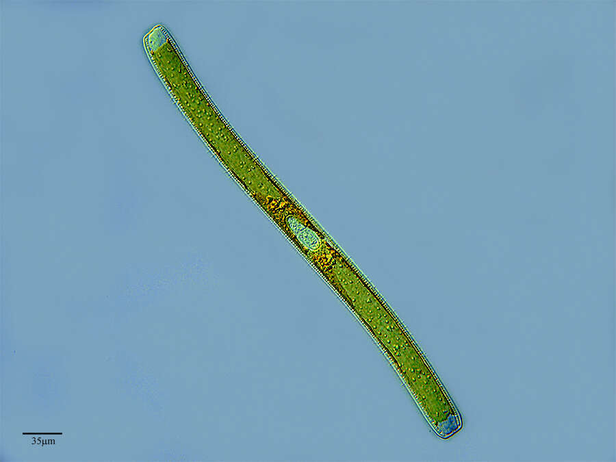 Image of Nitzschia sigmoidea