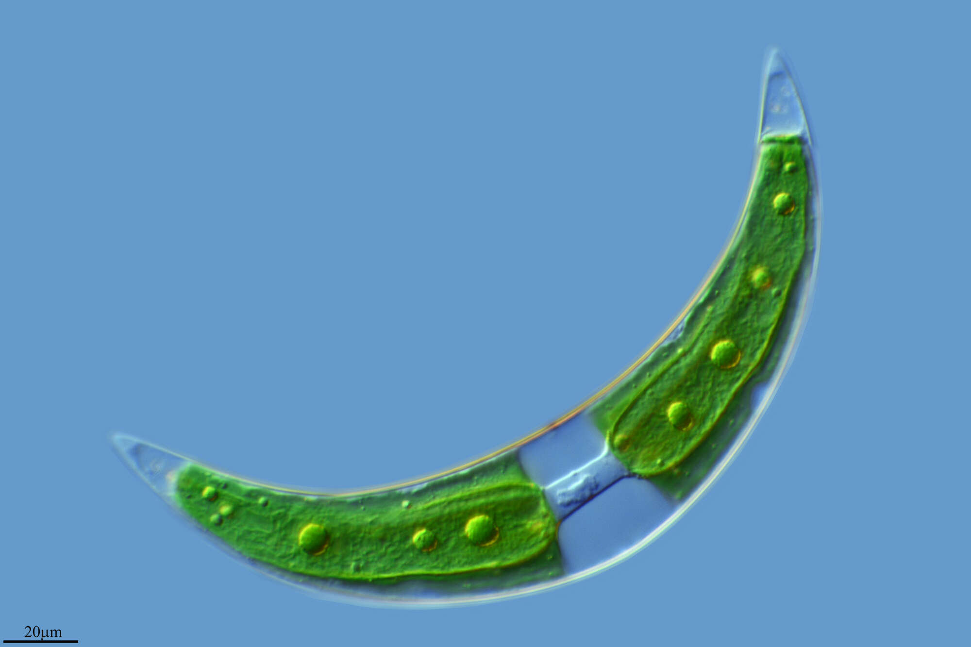 Image of Closterium moniliferum