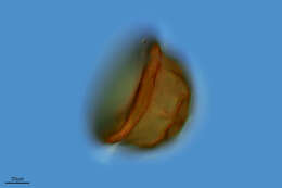 Image of Arcella vulgaris