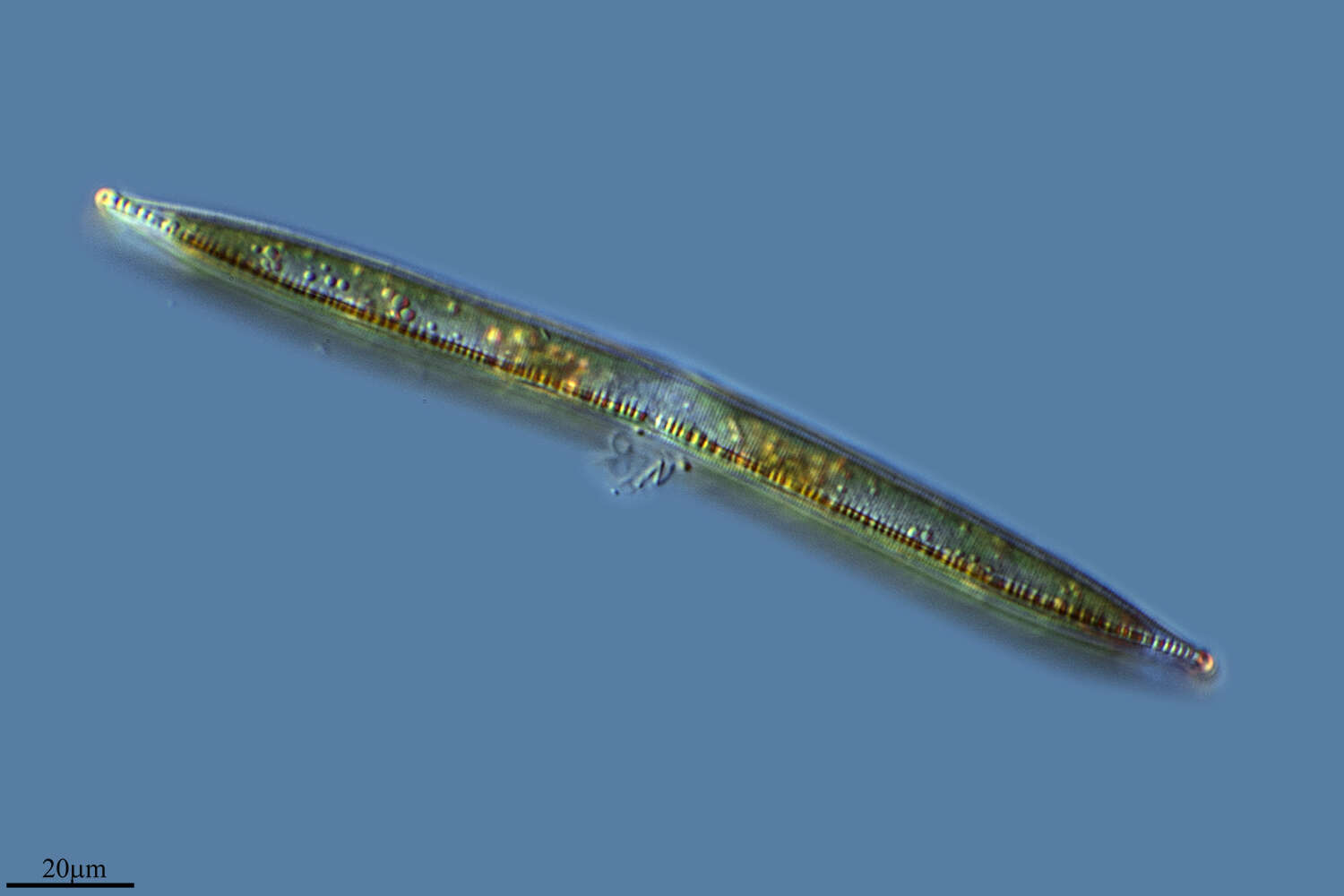 Image of Hantzschia elongata