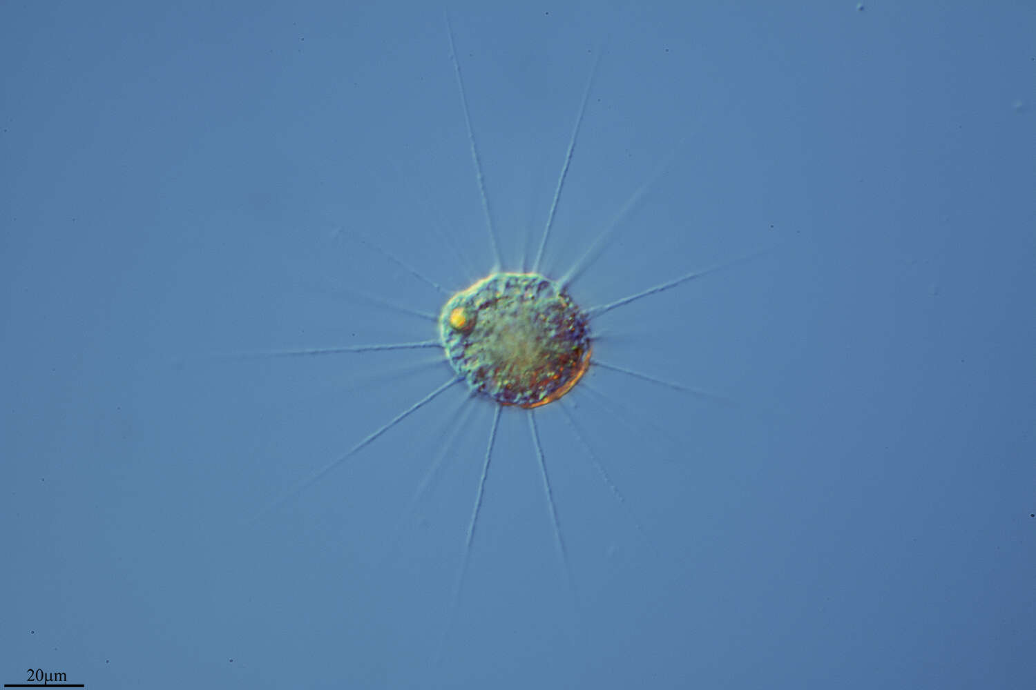 Image of Actinophrys
