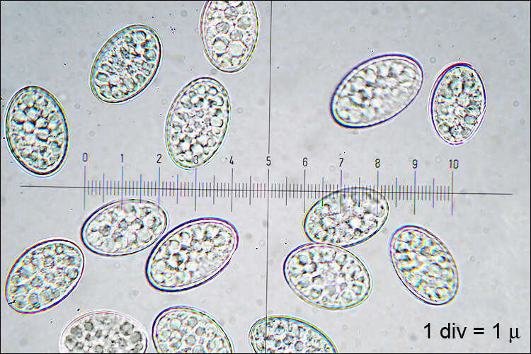 Image of Scutellinia