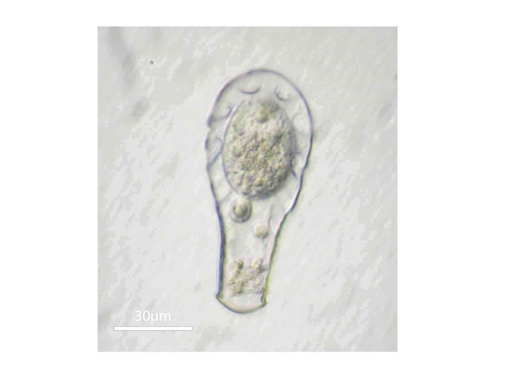 Image of Hyalosphenia elegans