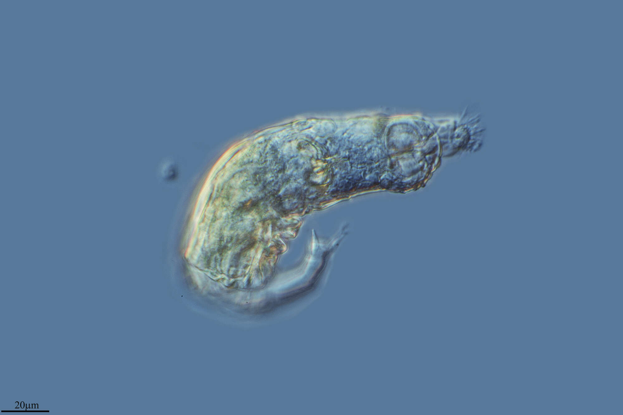 Image of Bdelloidea