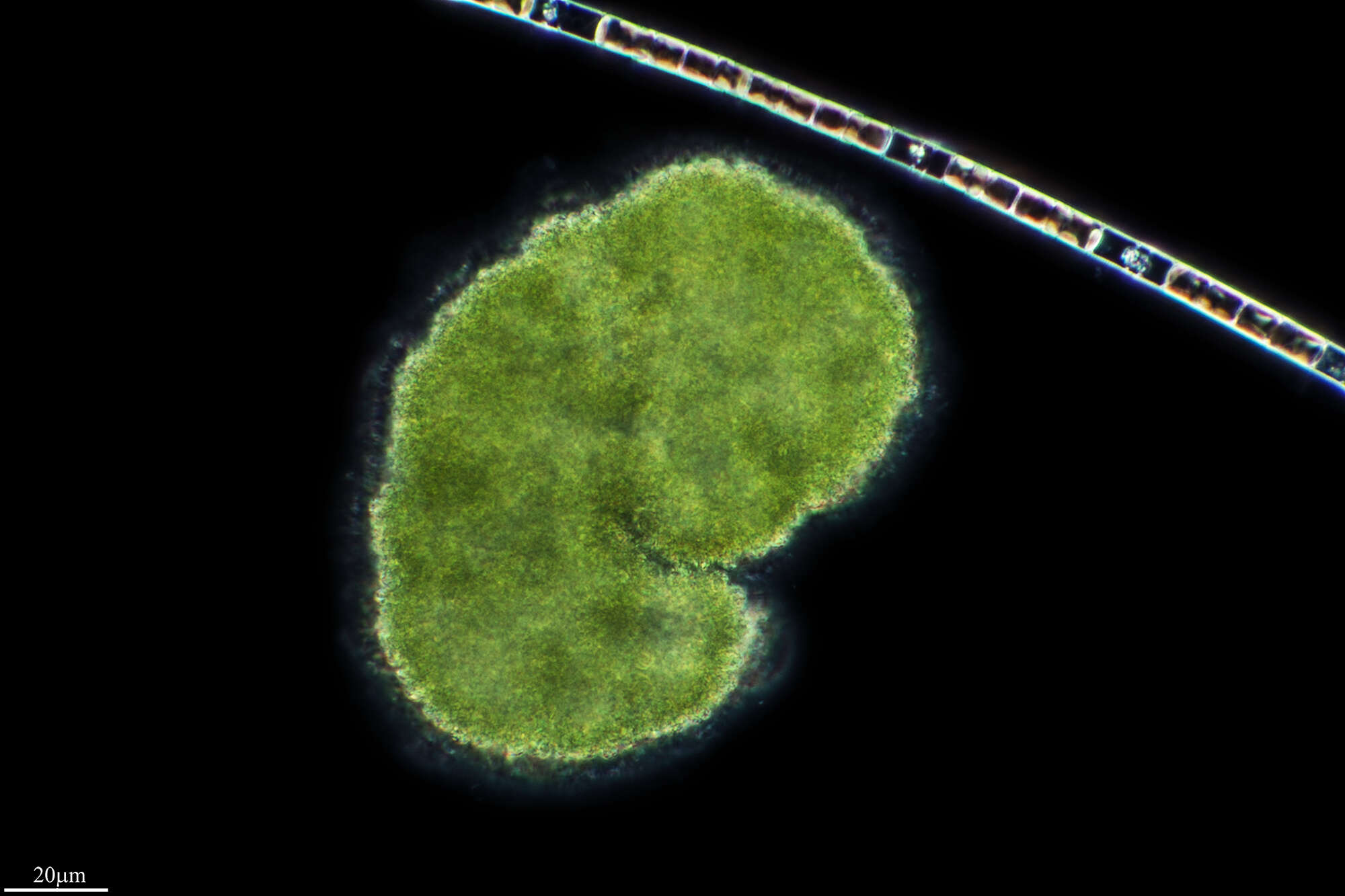 Microcystis botrys resmi