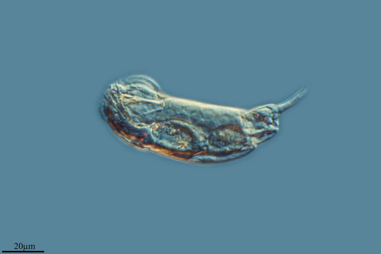 Image of Cephalodella