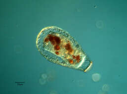 Image of amoeboid protists
