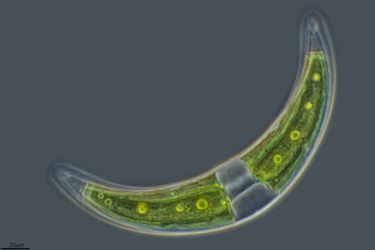 Closterium moniliferum resmi