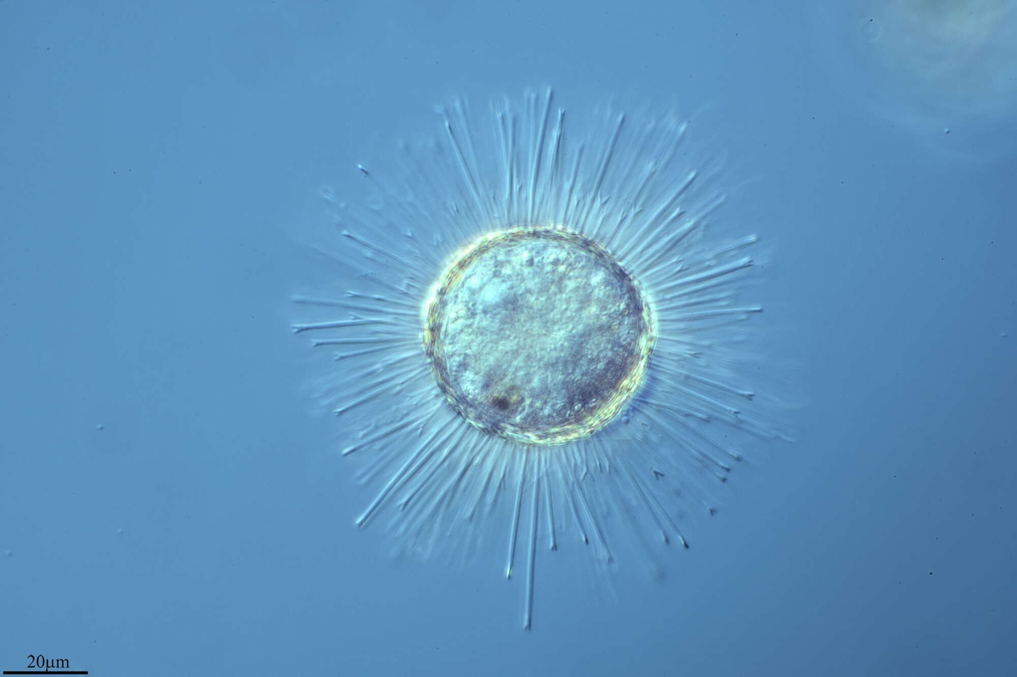 Image of Acanthocystidae