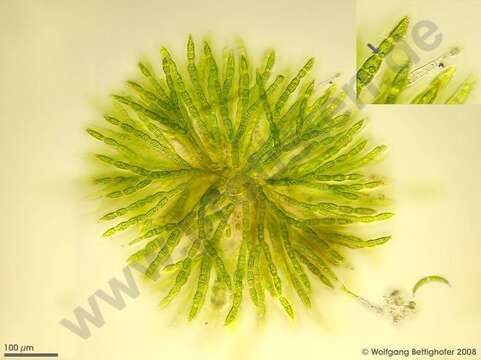 Image of Chaetophoropsis B. Wen Liu, Qian Xiong, X. Dong Liu, Z. Yu Hu & G. Xing Liu 2019