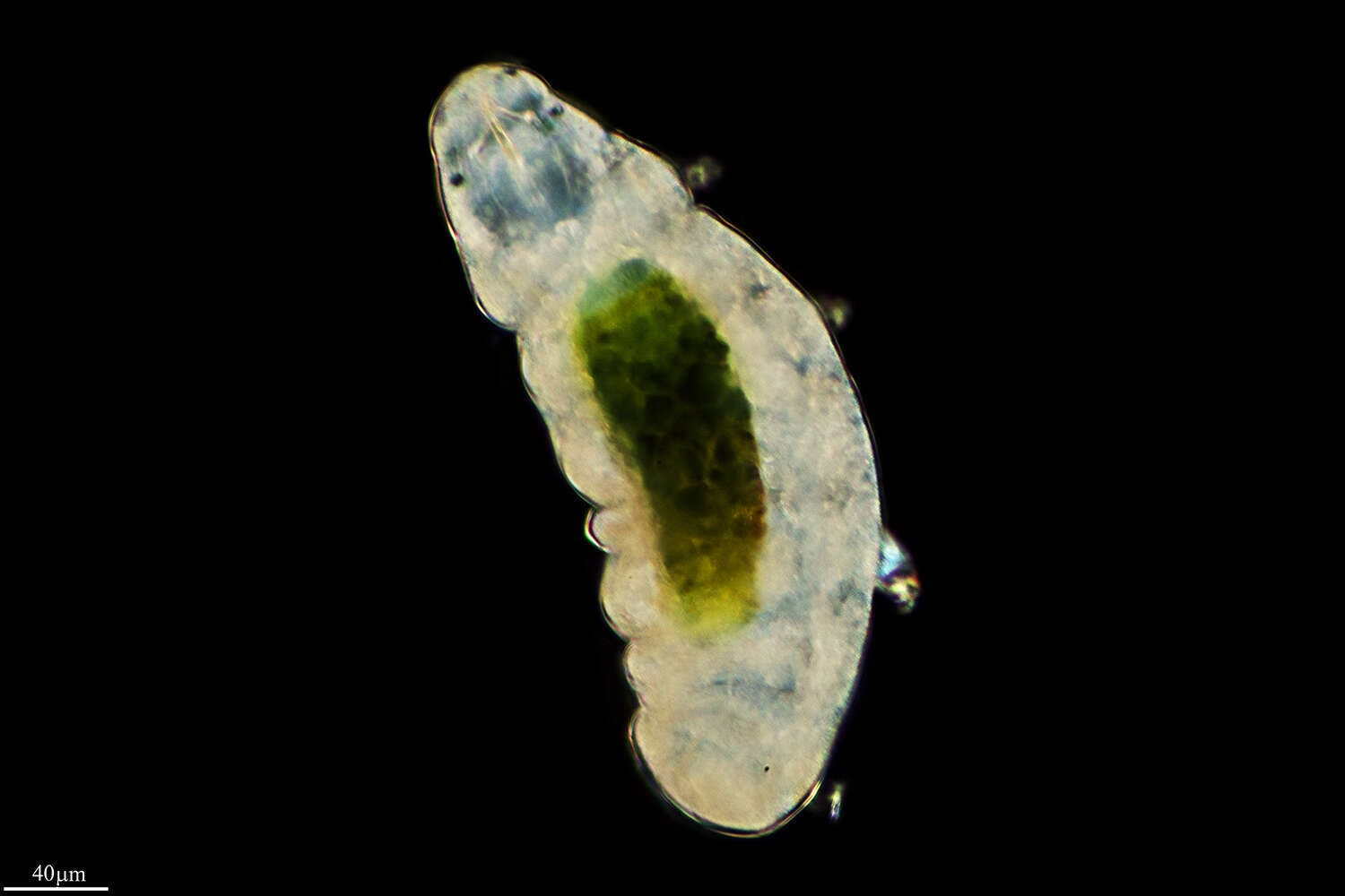 Image de Tardigrada