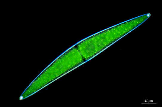 Image of Closterium lunula