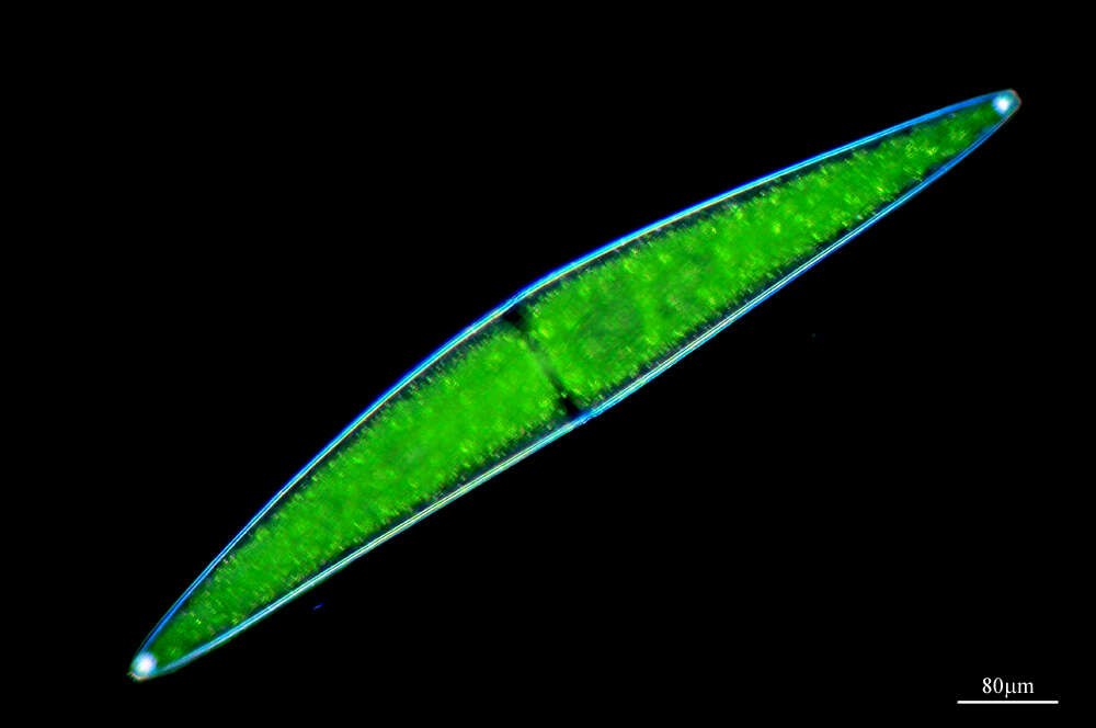 Image of Closterium lunula