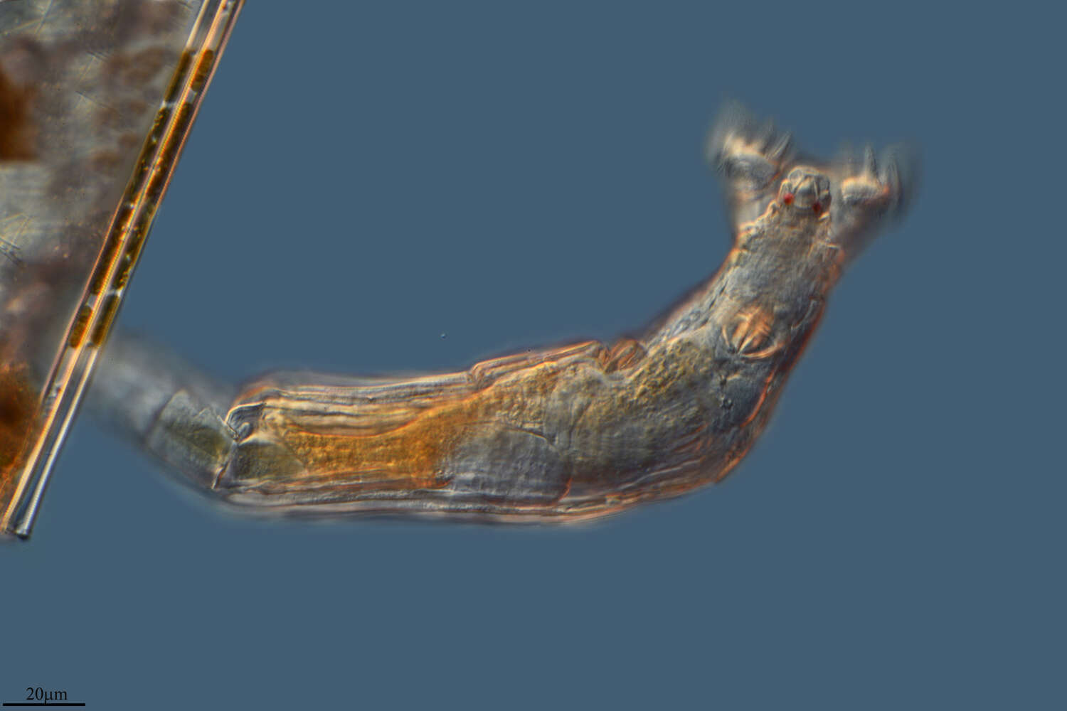 Image of Bdelloidea