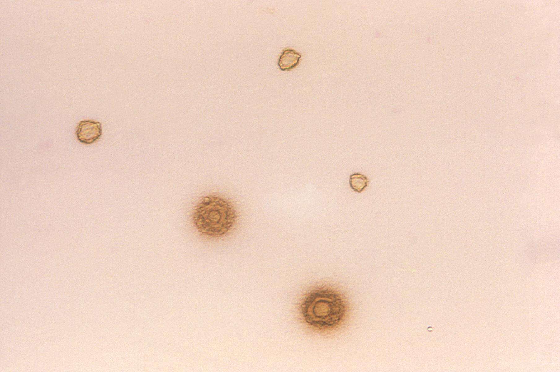 Image of Mycoplasma
