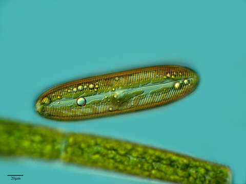 Image of Pleurotaenium ehrenbergii