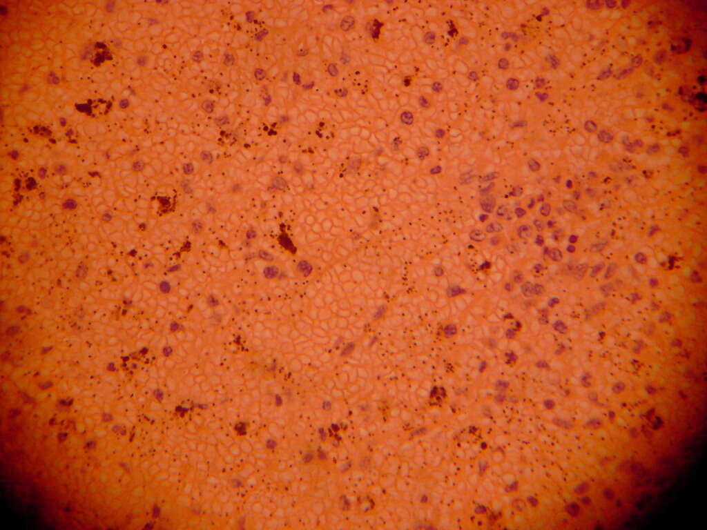 Image of apicomplexan parasites