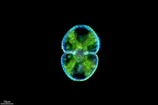 Image of Cosmarium botrytis