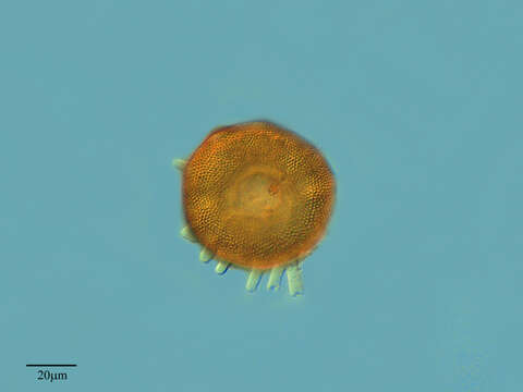 Image of Arcella gibbosa