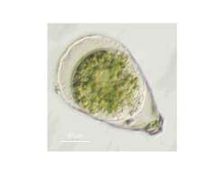 Image of Hyalosphenia