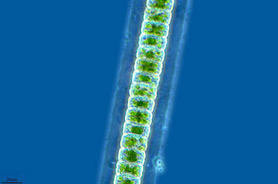 Image of Hyalotheca dissiliens